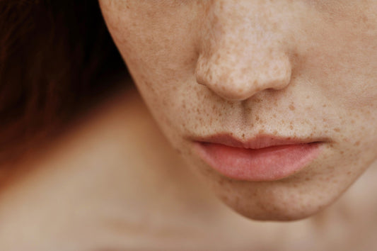Close-up of a woman's face with freckles across her nose, cheeks and chin